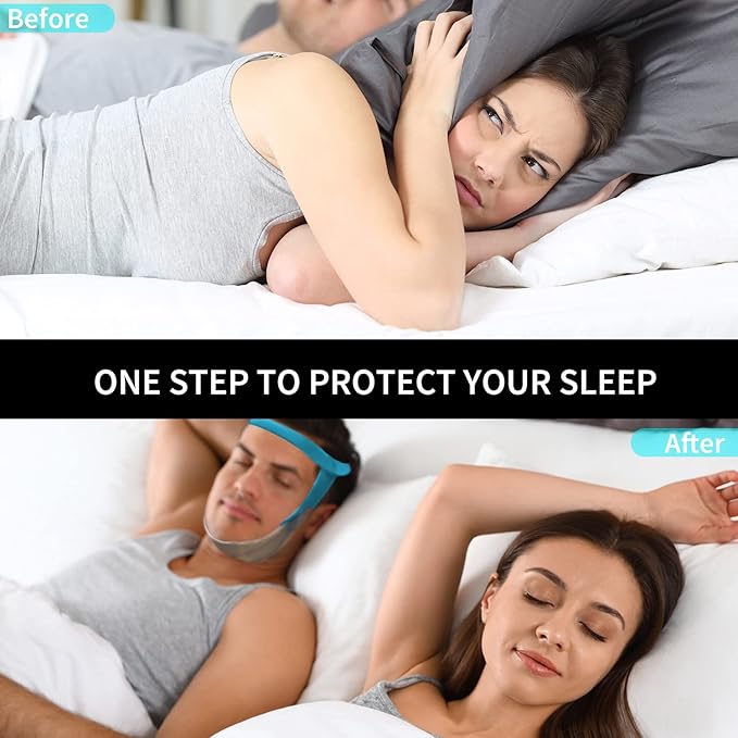 Anti Snoring Chin Strap for Men and Women, Comfortable Chin Strap for Cpap Users, Adjustable Stop Snoring Chin Strap Snoring Solution Chin Straps to Keep Mouth Closed While Sleeping (Blue)