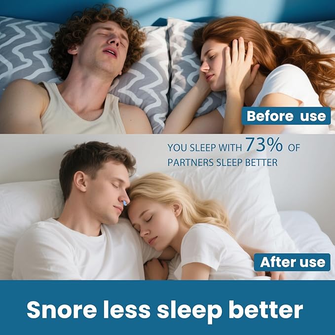 Nasal Dilators for Snoring (Blue)