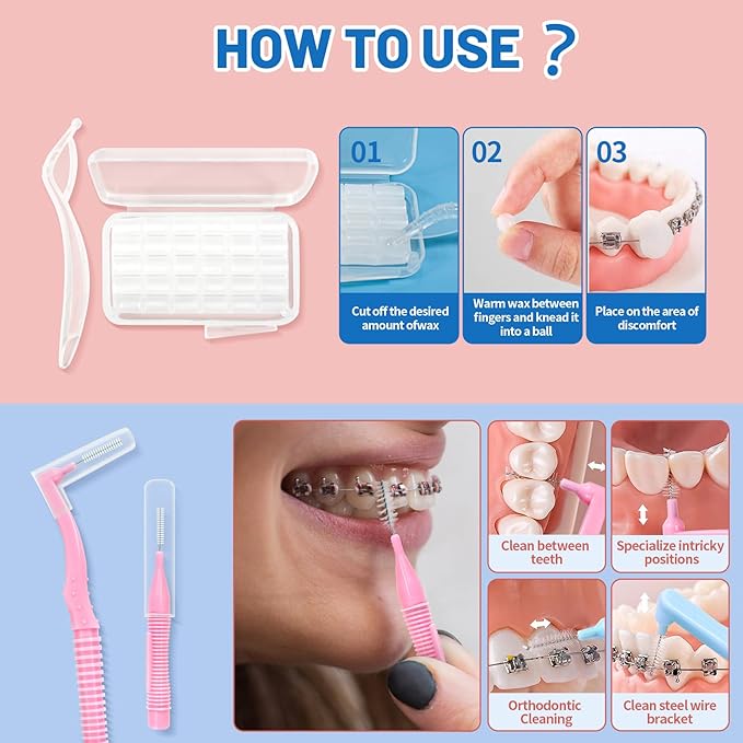 Orthodontic Care Travel Kit | V-Shape Toothbrush with Soft Bristles, Interdental Brushes, Orthodontic Wax, and Breathable Case | Portable Dental Kit for Braces and Aligners（BLUE）