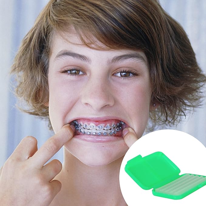 MorTime 12 PACK Braces Wax Dental Wax with Colorful Storage Cases, 60 Orthodontic Wax Strips for Braces Aligners Wearer