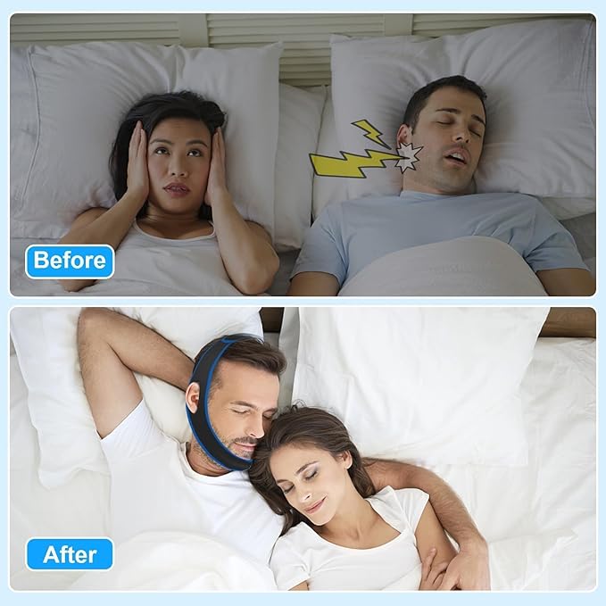 Anti Snoring Devices Anti Snoring Chin Strap for Men Women Adjustable Stop Snoring Solution Chin Straps Sleep Aids for Snoring Mouth Breather Devices