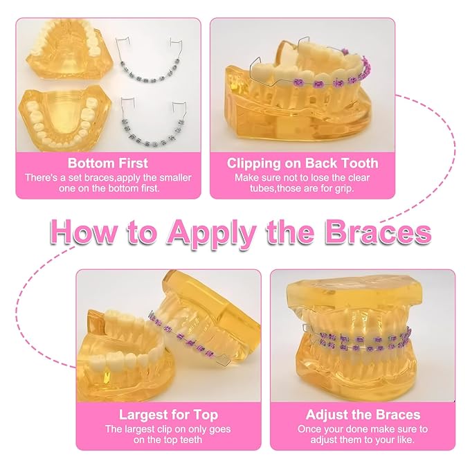 4 Pair of Temporary Tooth Decoration, Teeth Retainer Practical Brackets para Dientes Sturdy Retenedores de Dientes Ortodoncia Props for Dental Students to Practice (Pink)