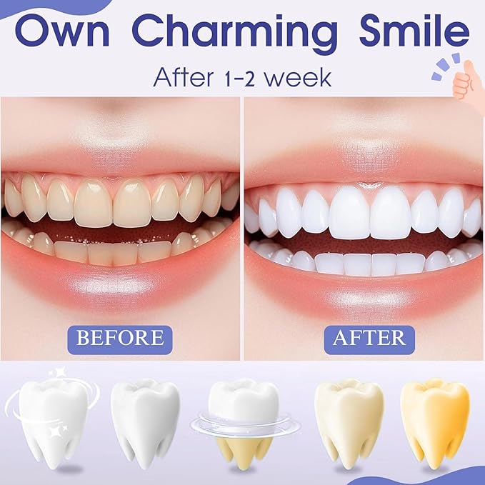 Teeth Whitening Pen, Teeth Whitener Kit Tooth Whitening Pen Gel Effective for Professionally Stain Removal, Painless, Low Sensitivity(Pack of 2)