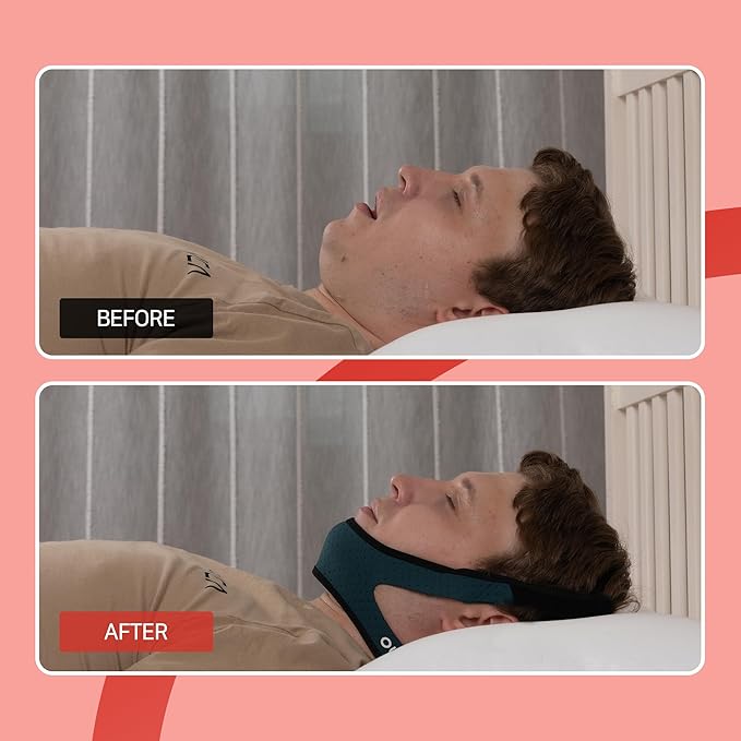 OLG Snore Stopper Chin Strap for Men CPAP Compatible Jaw Support Breathable Mesh – Anti Snoring Device