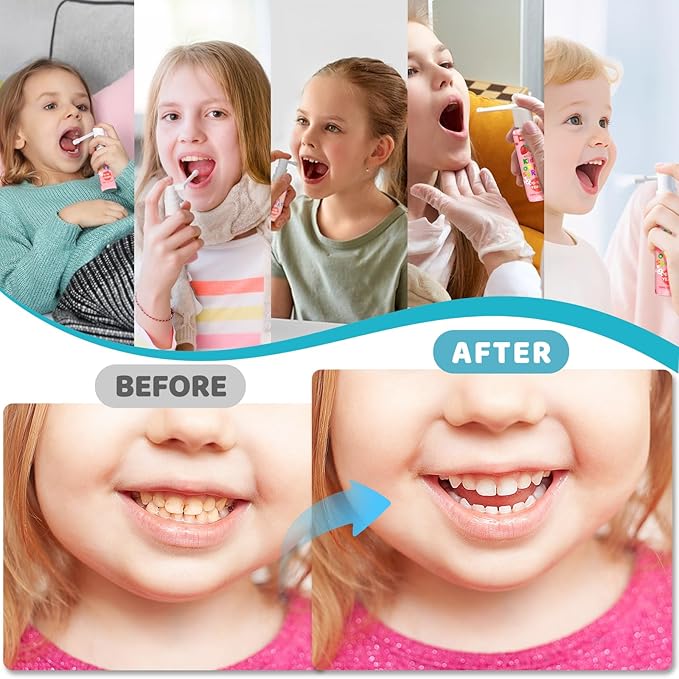 Kids Oral Spray, 3PCS Toddler Toothpaste Helper for Cavity Repair & Fresh Breath, Kids Probiotic Mouth Spray with Fluoride Free for Newborn to 12 Years 3 Flavors（Total 3.03fl oz）