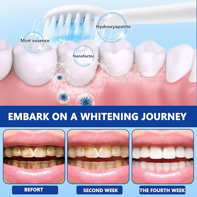 7.5% Nano Hydroxyapatite Toothpastes for Enamel Protection and Tooth Strengthening, Fluoride-Free Cooling Mint, Promotes Fresh Breath, Daily Use for Oral Health Mild Mint, 4.23 Oz（3pcs）