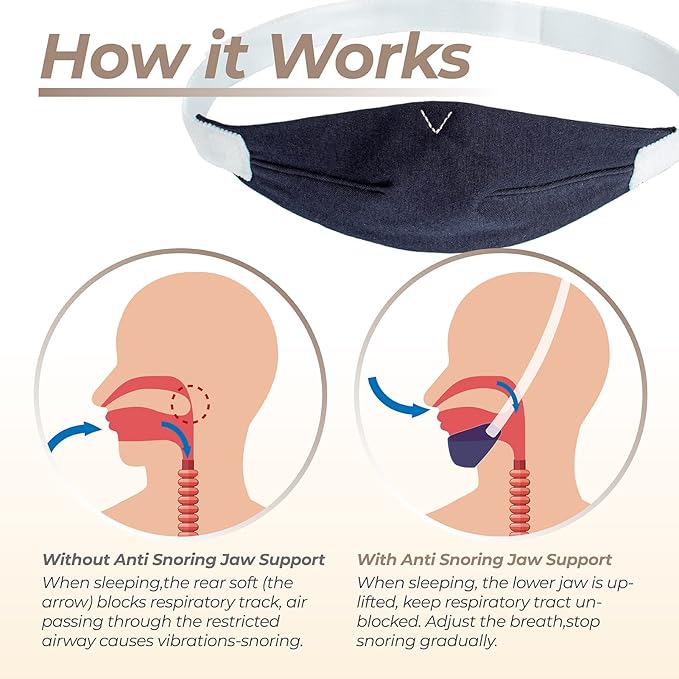 PalpitateC Upgrades Chin Strap Effective Mouth-Snoring Relief, Anti Snoring Men Women Universal, Adjustable Snoring Solution Effectively Regulate Snoring and Regulate Sleep, Chin Strap Resmed - 1 Pack