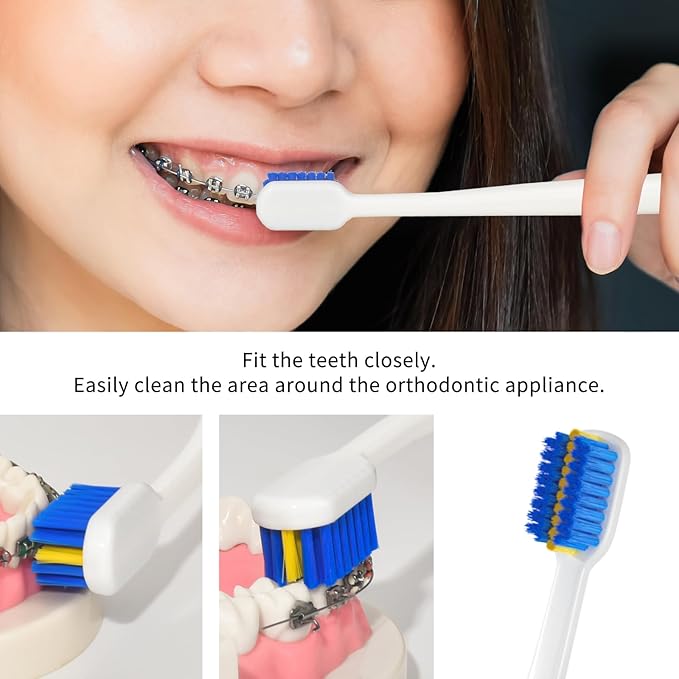4 Pcs Orthodontic Toothbrush for Braces U-Shaped Soft Bristle with 4 Toothbrush Head Cover（Blue+White (4 Pack)