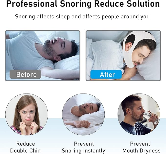 Chin Strap for Cpap Users Anti Snoring Devices - Forzacx Breathable Cpap Chin Strap Snoring Solution, Soft Non-Stick Hair Snore Stopper, Elastic Easy to Wear - White