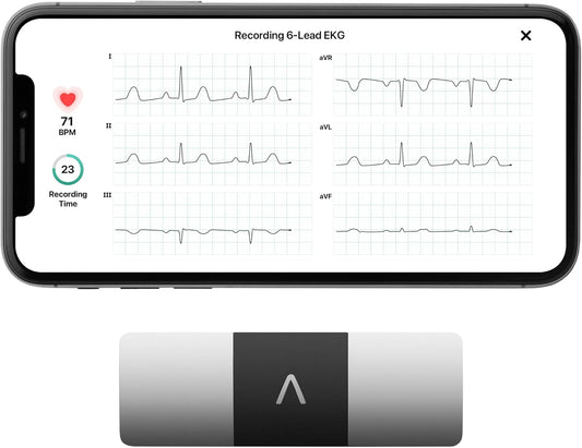 KardiaMobile 6-Lead Personal EKG Monitor – Six Views of The Heart – Detects AFib and Irregular Arrhythmias – Instant Results in 30 Seconds – Works with Most Smartphones