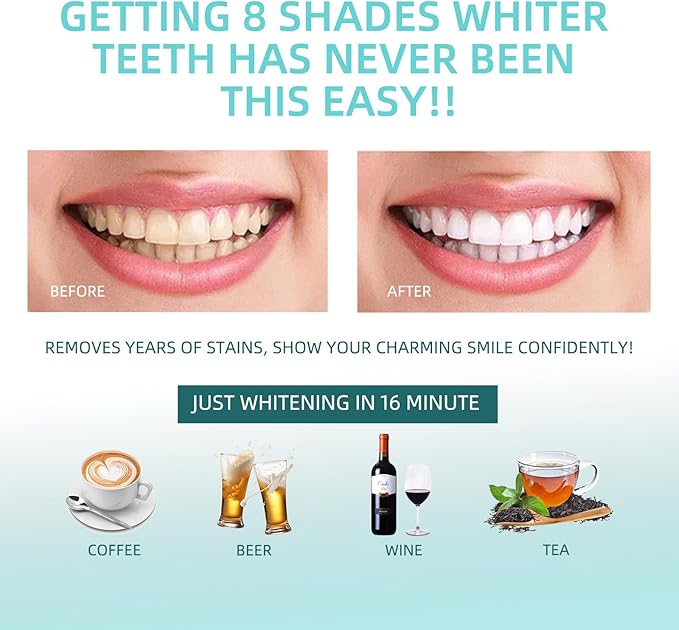 Teeth Whitening Kit with 32xLED Light Professional Complete at Home Smart Phone Whitening System - Best Tooth Whitener Gel Refill - Safely Connected with iPhone/Android/USB for Home Use