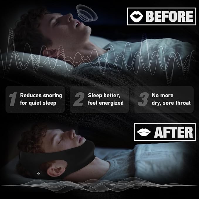Anti Snore Chin Strap for Sleeping Jaw Tape Mouth Snoring Sleep Devices Stopper Solution Cpap Users Head Mouthpiece to Keep Closed Mandibular Advancement Reducing Aids Men Women