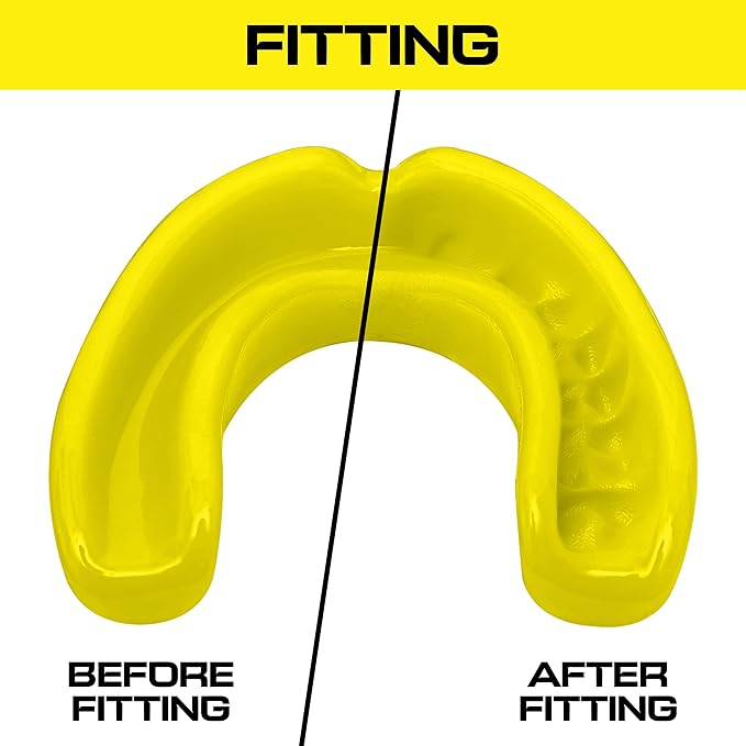 Sports Mouth Guard for Kids,Youth,Boys,Girls,Child Teen Mouthguard with Case (BPA Free) for Boxing, Martial Arts,MMA Karate,Lacrosse,Football,Soccer and All Contact Sports (Yellow)