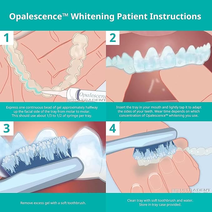 Opalescence 35% Gel Syringes Teeth Whitening - Refill Kit (4 Syringes Total) Carbamide Peroxide. Made by Ultradent, in Melon Flavor. Tooth Whitening Refill Syringes 5404-1