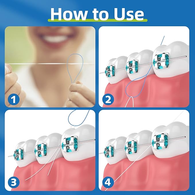 Floss Threaders,Essential Tool for Maintaining Oral Health with Braces, Bridges, and Implants 400 Count (Pack of 8)