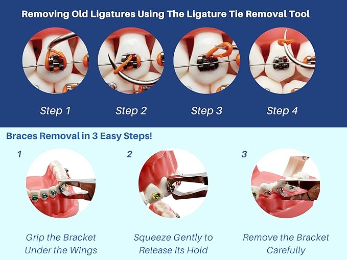 ARTMAN INSTRUMENTS Orthodontic Braces Removal Tool Kit Bracket Removing Pliers & Ligature Ties Remover Scraper Tarter Tool Easy Braces Removing Tool