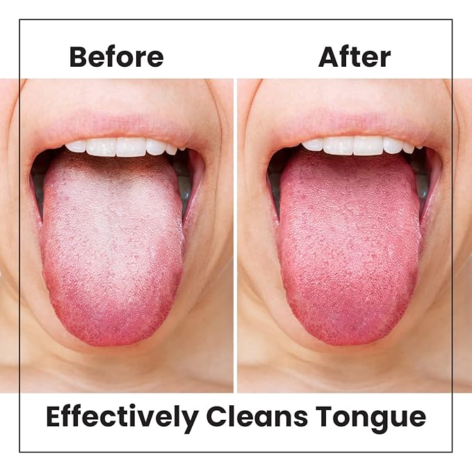 Lindo Eco-Friendly Tongue Cleaners, Tongue Scrapers, Oral Care Cleaners, Reduce Bad Breath, Soft Silicone Bristles, Natural, Vegan, 2 Pack