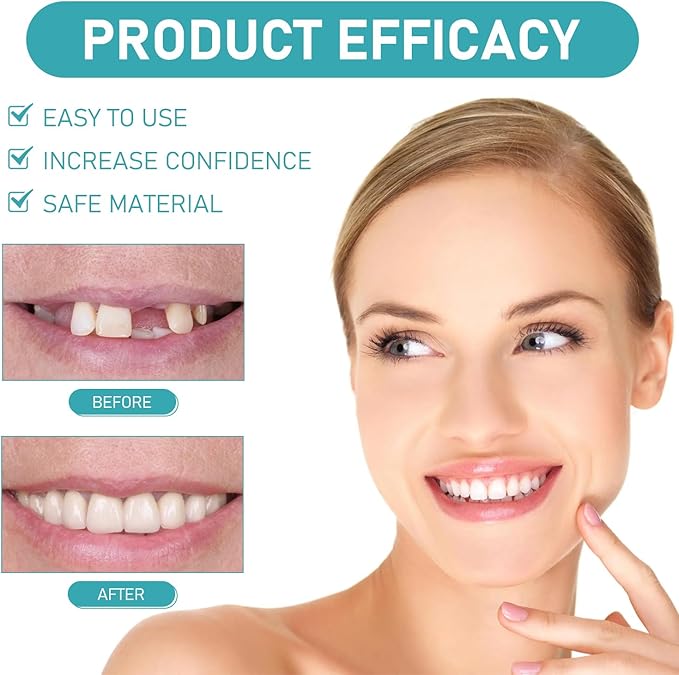 Minceetbien Dentures, Minceetbien Silicone Reline Denture Set, Comfortable and Secure, Adjustable Snap-in Upper and Lower Denture Kit for Instant Smile Restoration