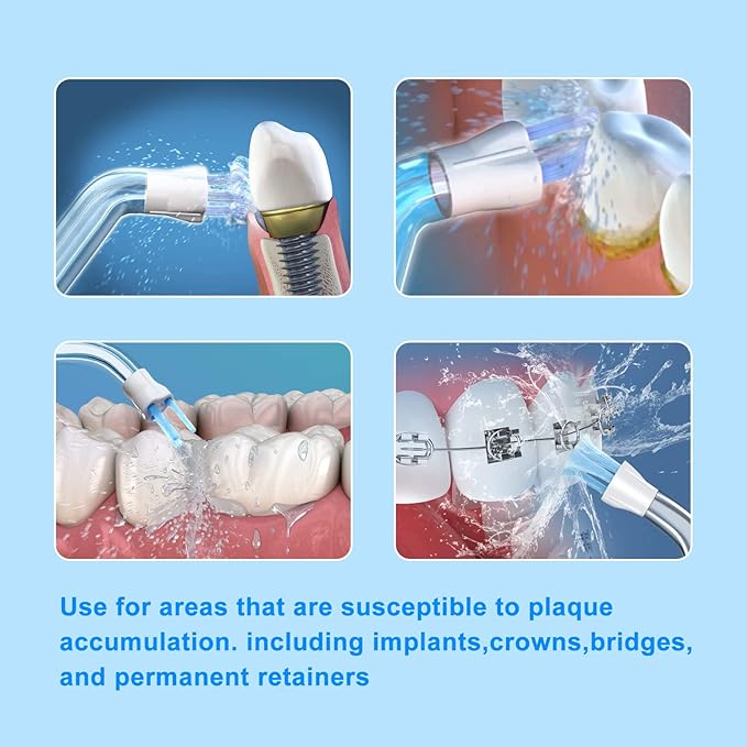 Replacement Tips Compatible with Waterpik Water Flosser and Other Oral Irrigators, Plaque Remove Bristles (6 Plaque Chaser Tips)