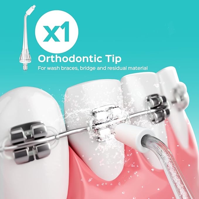 COSLUS Original Water Flosser Replacement Tips: Replacement Heads Compatible with COSLUS, Aquasonic, Nicwell, Oralfree, WELLFINE, Hangsun, Tovendor Water Dental Pick, Flosser Accessory, 5 Mix Jet Tips