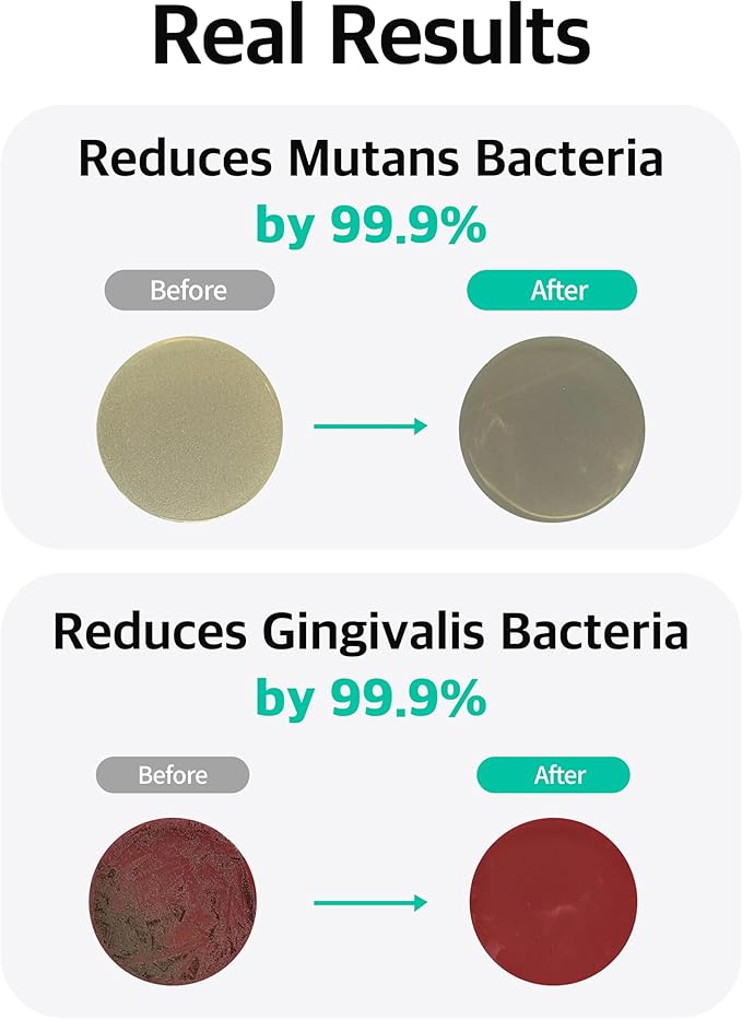 Live Orals PureBreath Toothpaste 80g (Pack of 5)- Fluoride-Free, Odor Neutralizing, Enamel Strengthening, Gentle Cleaning, Mint Fresh, Naturally Derived Ingredients, Sensitive Teeth Friendly