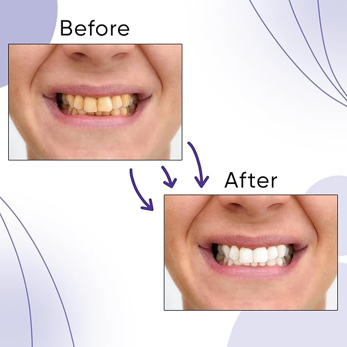 Violet Whitening Foam 50ml – Bright White Teeth with Color-Correcting Toothpaste