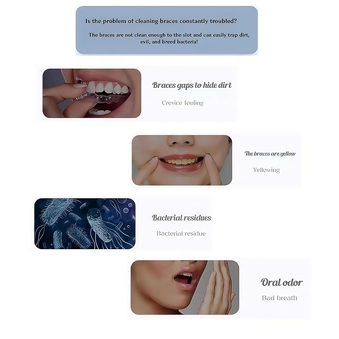 Three Modes Denture Cleaner Machine for Invisalign Cleaner,50kHz Ultrasonic Retainer Cleaner Machine,200ML Mouth Guard Cleaner,For Dentures,Mouth Guards,Braces,Aligners,Toothbrush,Jewelry