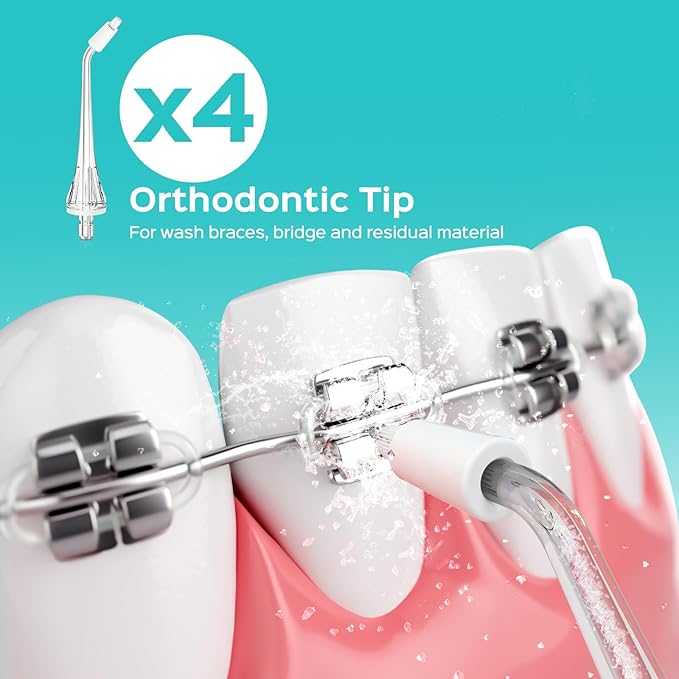 COSLUS Original Water Flosser Replacement Tips: Replacement Heads Compatible with COSLUS, Aquasonic, Nicwell, Oralfree, WELLFINE, Tovendor Water Dental Pick,Flosser Accessory, 4 Orthodontic Tips