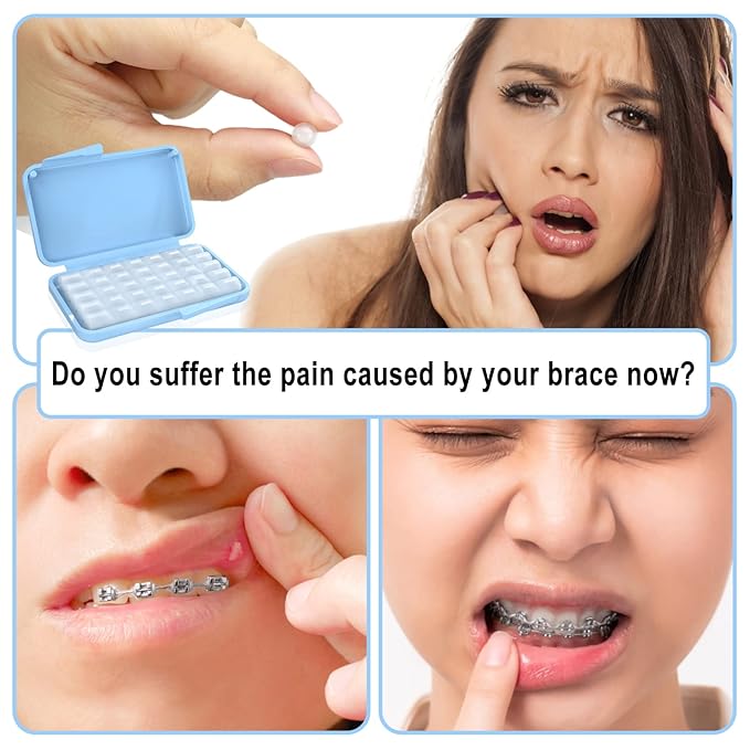 BVN Braces Wax Dental Wax: 20 Boxes Orthodontic Wax Strips, Braces Wax for Teeth, Ortho Wax for Braces, Tooth Wax, Mouth Wax, Oral Wax for Braces, Relief Wax for Braces Wearer Aligners Patients