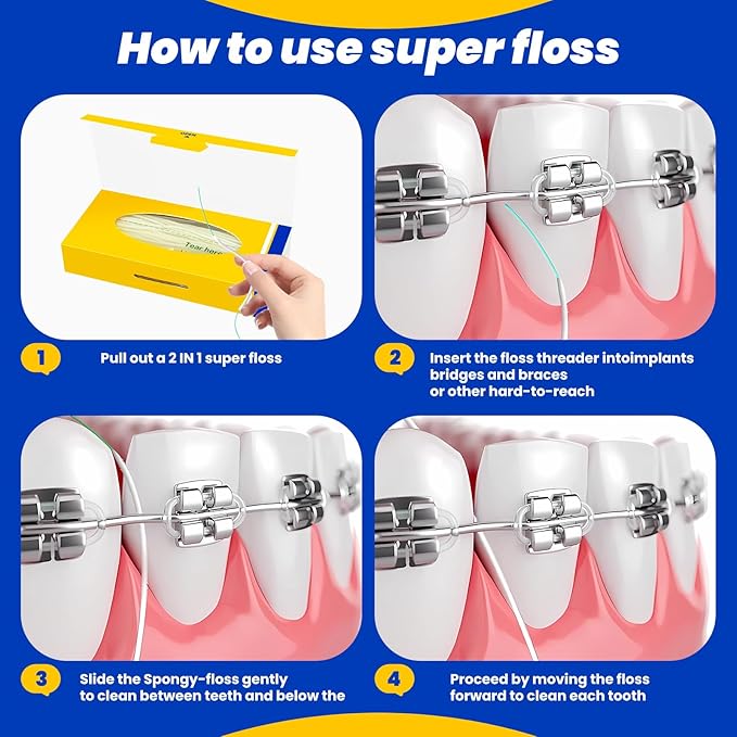 Dental Floss for Braces,Pre-Cut Strands Floss,Threaders for Bridges,Threaded Floss for Braces & Bridges,50 Counts(Pack of 2)