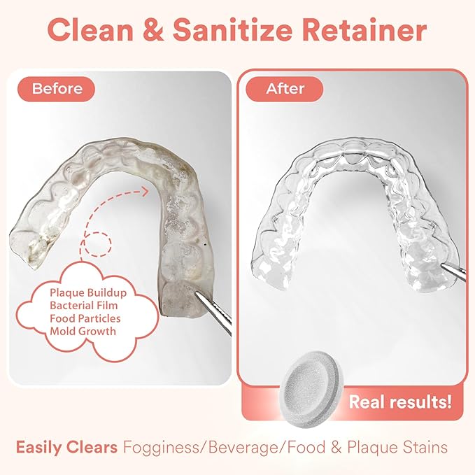 Weiss Naturals Retainer Cleaning Tablets, Invisalign Cleaner, Remove Stains, Odors & Plaque, FSA & HSA Eligible, Night Guard Cleaner PERSULFATE & DYE-FREE 2-Month Supply, Denture Cleaners, 60 Tablets