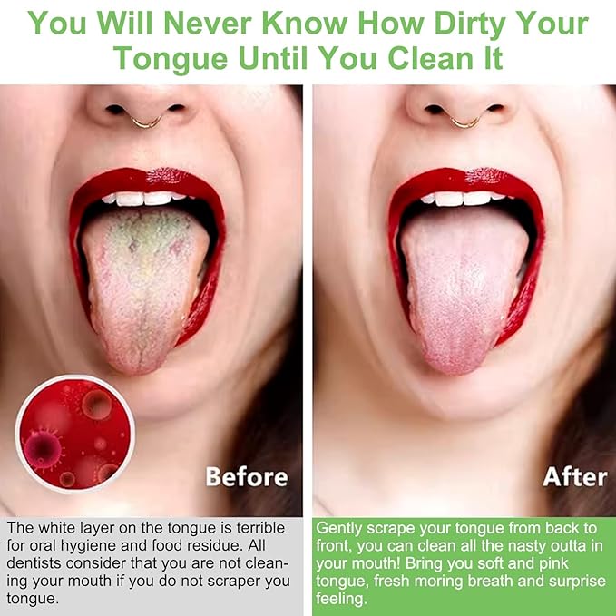 Tongue Scraper, Metal Tongue Scraper for Good