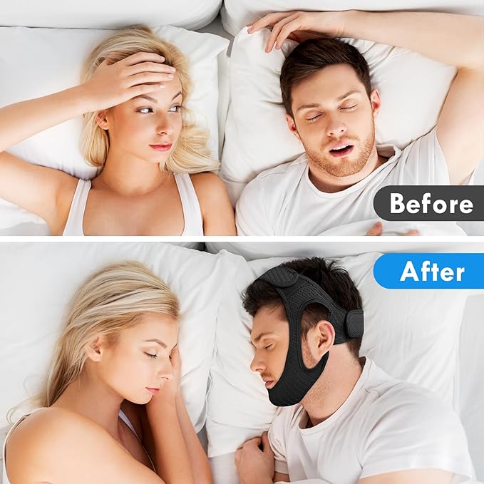 Anti Snoring Chin Strap, Comfortable Chin Strap for Sleeping Anti Snore Chin Strap, Adjustable and Breathable Jaw Strap for Sleep for Men or Women, Non-Stick Hair Anti Snoring Devices, Black