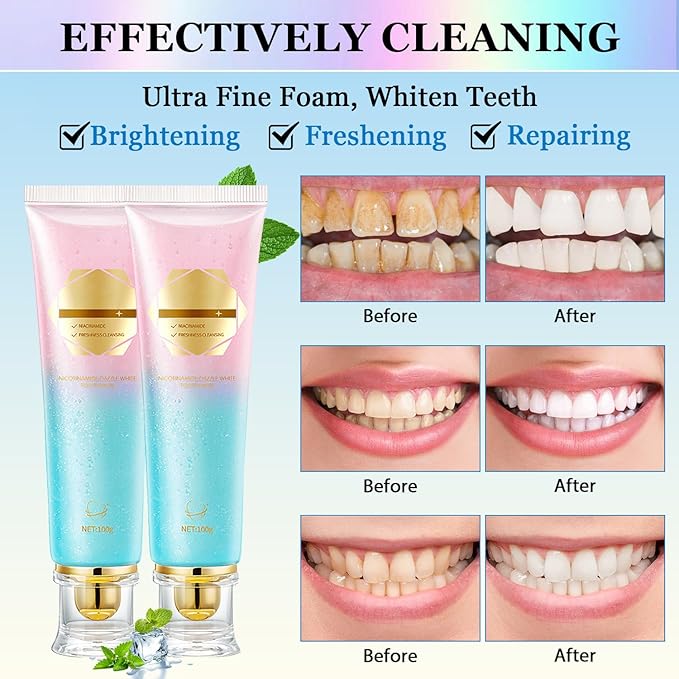 2Pcs Acssart Radiant Whitening Toothpaste, Niacinamide Intensive White Toothpastes, Nicotinamide White Toothpastes, Deep Cleaning Care