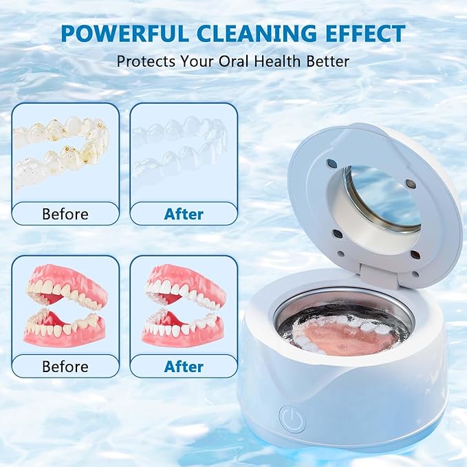 Ultrasonic Retainer Cleaner Machine 45kHz 200ml Portable Ultra Sonic Retainer Cleaner for Dental Retainer Mouth Guards Aligner Night Guard Braces Toothbrush Jewelry