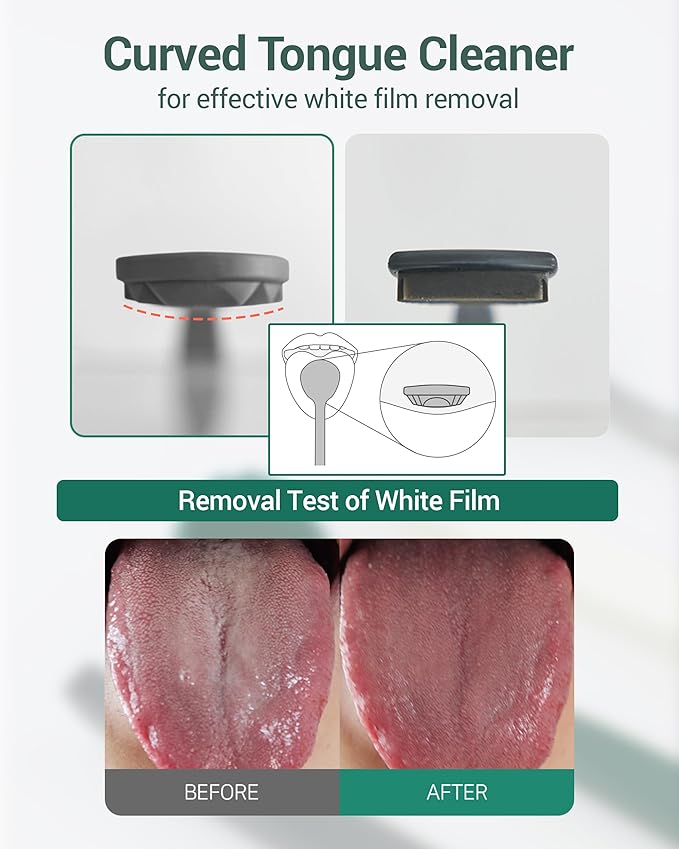 DEARCUS Korean Tongue Scraper with 3 Replaceable Heads - 100% BPA Free TPE Tongue Cleaner - Reduce Bad Breath & Without Hurt - Hygienic Scraper - Modern & Simple Design (White)