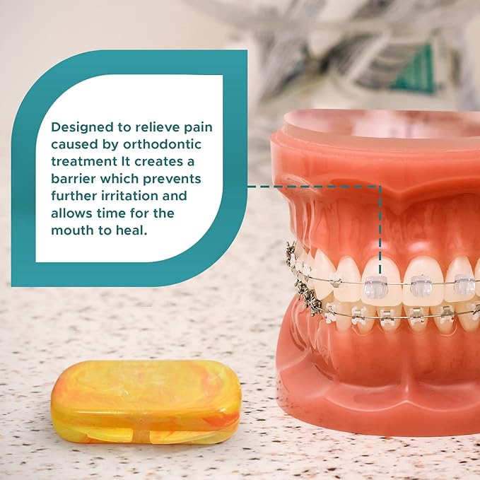 Orthodontic Dental Wax for Braces – Premium Braces Wax in Designer Marble Cases, Tooth Wax for Braces, Clear & Unscented, 3-Pack Assorted Colors