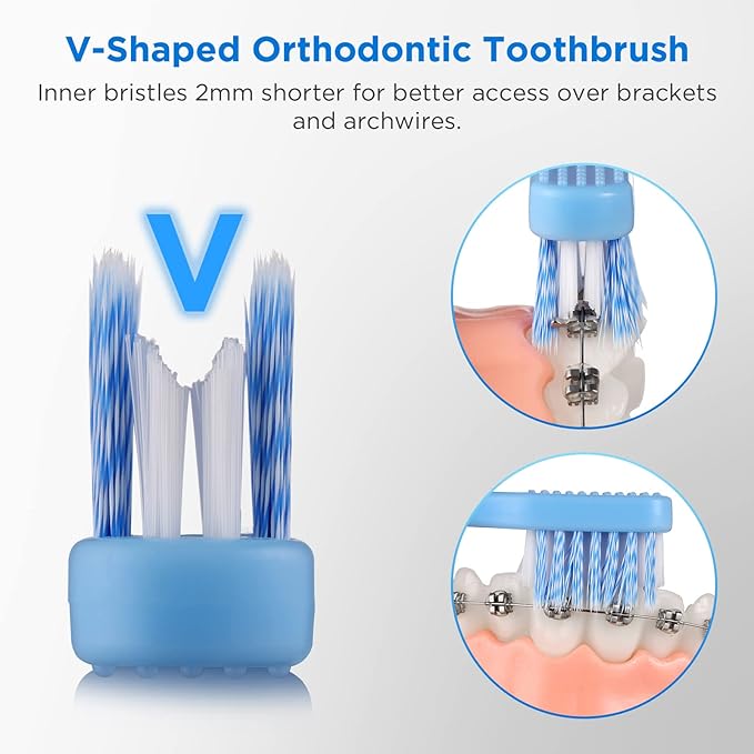 V-Shaped Orthodontic Toothbrush for Braces, Soft Bristles, 6 Count, with Interdental Brushes