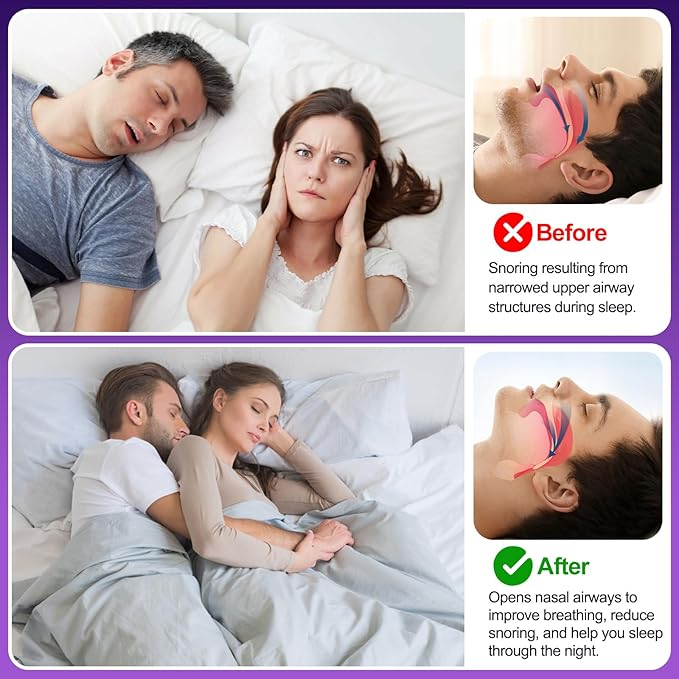 Nasal Strips for Snoring, 100 Count Extra Strength Nose Strips for Breathing, Anti Snoring Devices for Sports and Sleep, Help Stop Snoring, Relieve Nasal Congestion, Drug-Free,Deeper Sleep