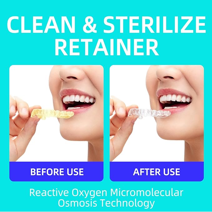 Retainer Cleaner Tablets,Denture Cleaning Tablets for Deep Remove Stains,Denture Cleaner Tablets 240 Tablets - Minty Fresh