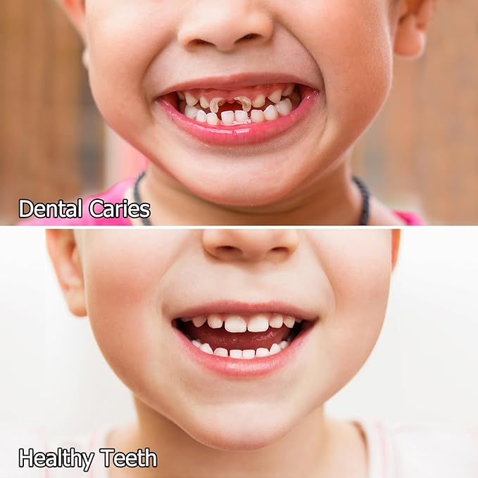 Kids Oral Spray, Toddler Toothpaste Helper for Cavity Prevention and Fresh Breath, Children Anticavity with Fluoride Free for Newborn to Preschoolers, Kid's Mouth Spray (1)