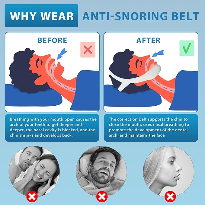 Chin Strap for Sleeping, Anti Snoring Chin Strap for Users, Chin Strap for Snoring Solution, Adjustable and Breathable Anti Snoring Chin Strap, Snoring Support for Men and Women