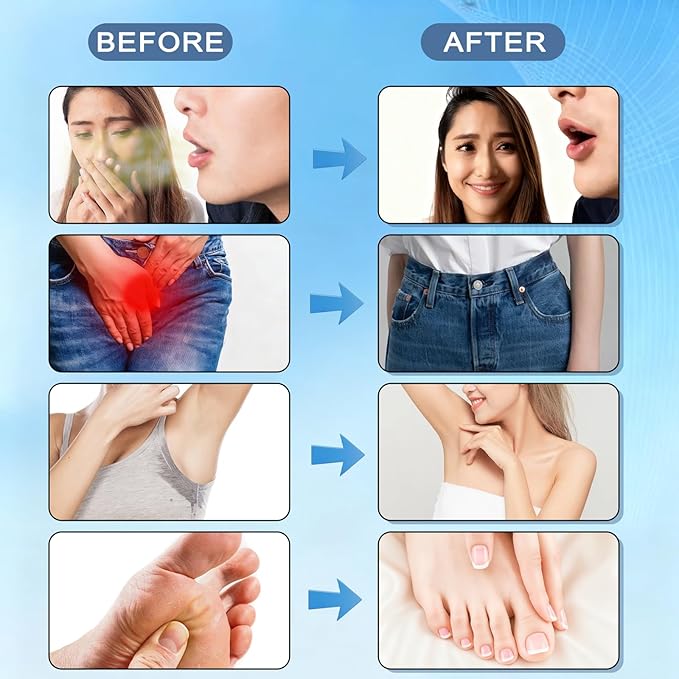 Zero Breath Bad Breath Capsules, 7-in-1 Body Deodorizing Supplement, with Chlorophyllin, Mint Extract, Probiotic Blend, Oral Freshness in 14 Days