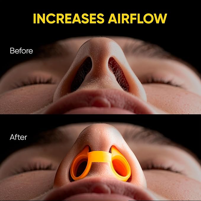 Anti Snoring Nose Vents – Nasal Dilators for Snore Relief & Better Sleep – Comfortable Silicone Snore Stopper – Anti Snoring Devices for Men & Women – 8 Pack + Travel Case