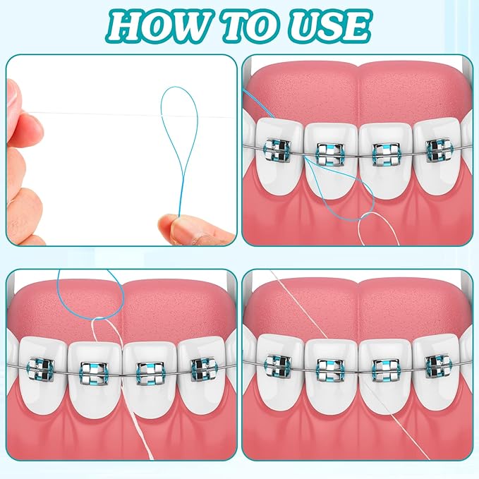 1000 Pcs Dental Floss Threaders Deep Clean Floss for Braces, Bridges, and Implants, Multifunctional Nylon Loop Design for Your Teeth, Pack of 20(Blue)