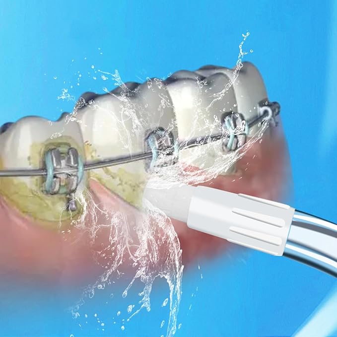 Replacement Tips for Waterpik Water Flosser, Replacement Orthodontic Tips Compatible with Waterpik Water Flossers and Other Brand Oral Irrigators (6-Pack)