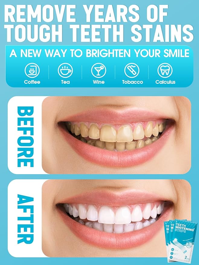 Oralfree Natural Teeth Whitening Strips - Sensitive Teeth Whitener - Enamel Safe Teeth Whitening Kit with Hydrogen Peroxide for Coffee, Wine, Tobacco, and Other Stains, 28 Strips (14 Treatment), Mint