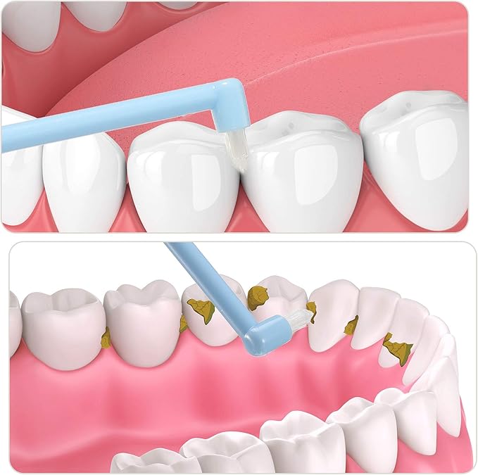 Patelai 12 Pcs End Tuft Toothbrush Soft Interdental Brushes Tooth Stain Remover Trim Toothbrush Single Brush for Implants Teeth Detail Cleaning Supplies(Orange, Rose Red, White and Blue)