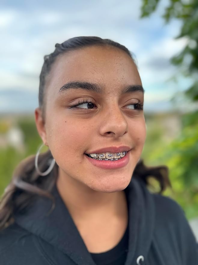 Orthodontic Wax – Original Honey, Natural Braces Protection, Long-Lasting Comfort, Pre-Cut Wax Pieces in Aluminum Travel Case (75 Buttons) - Fresh Mint