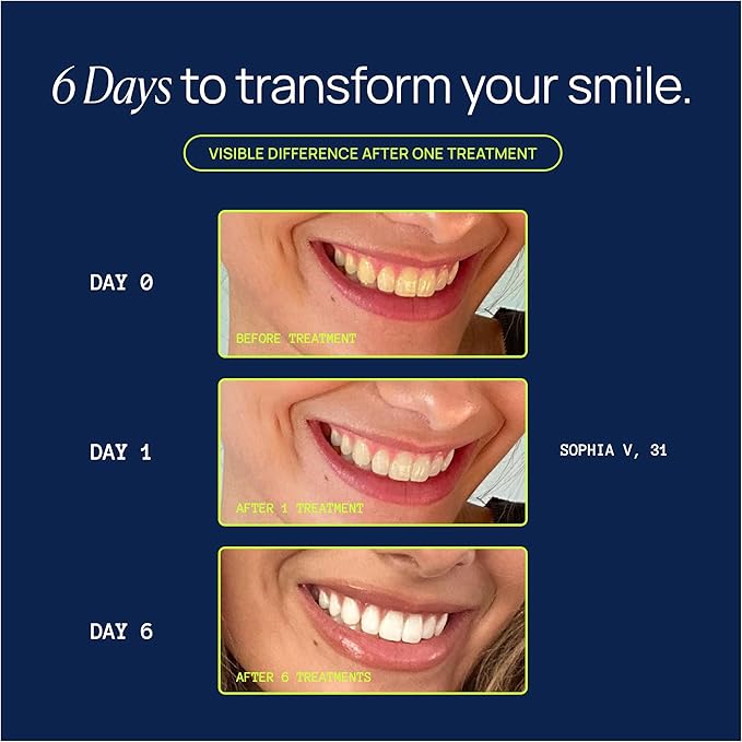 Laughland Gentle Teeth Whitening Kit, Phone-Powered LED Mouthpiece & 3 Whitening Gel Syringes, Sodium Bicarbonate, Aloe Vera & Mint, for Sensitive Teeth, at-Home Dental Care, 6+ Treatments